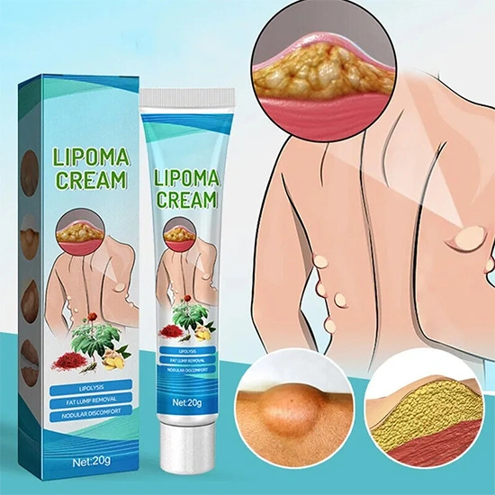 krem-za-lipomi-20g-4