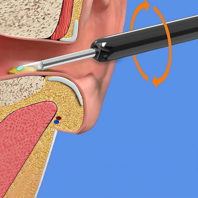 opis-endoskop-za-cistenje-usi-2